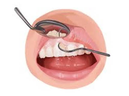 Preventive & General Dentistry